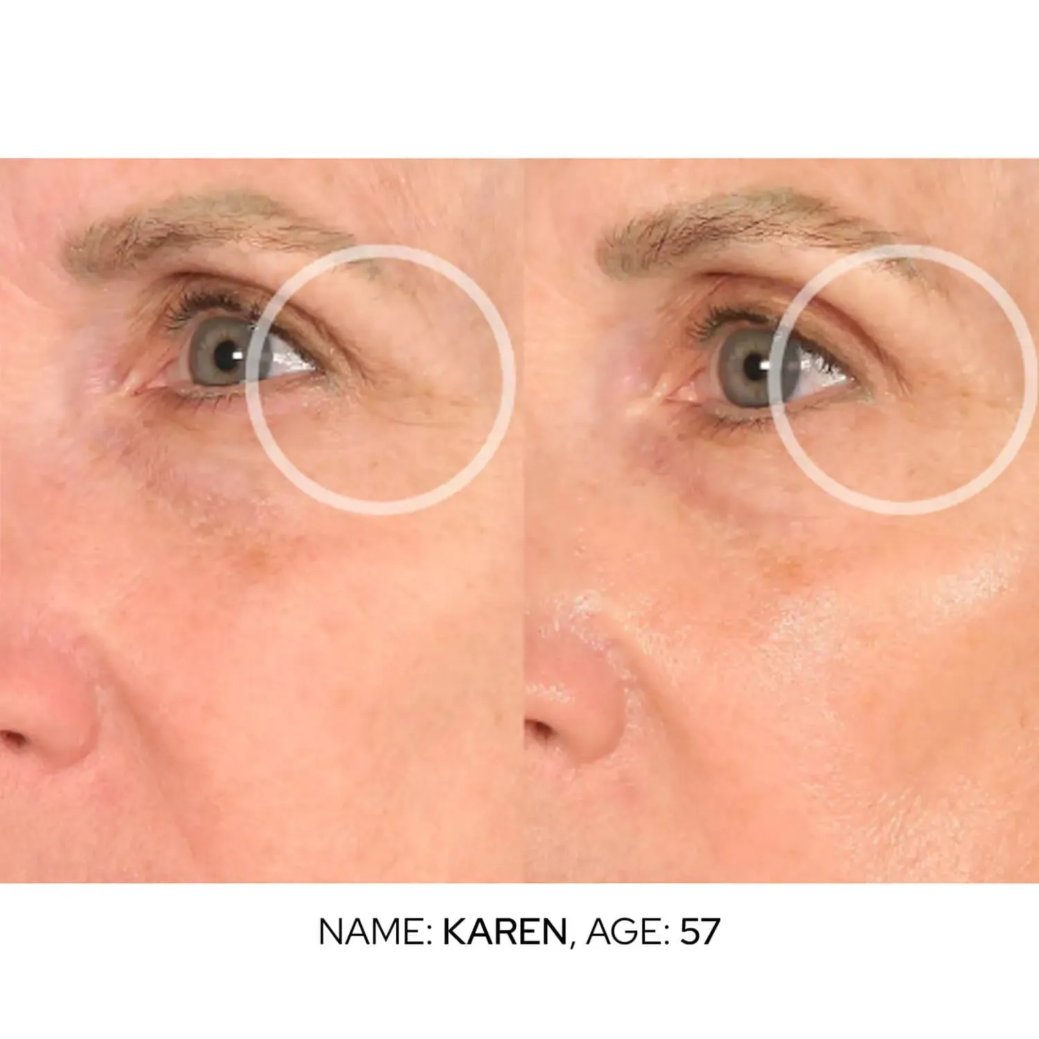 Cryo Eye Cream