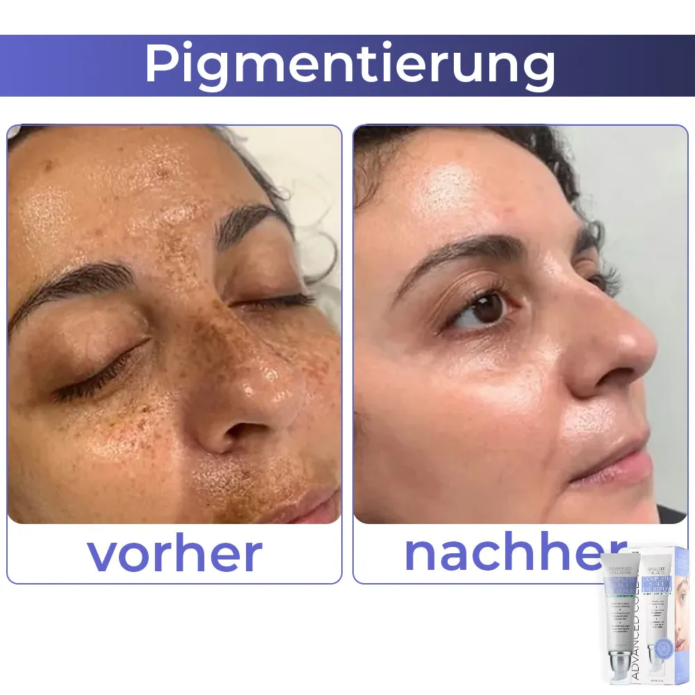 flysmus Fortgeschrittene Kollagen Vollstndig Augencreme