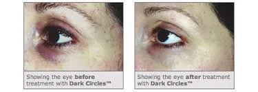 Medik8 Dark Circles Eye Gel