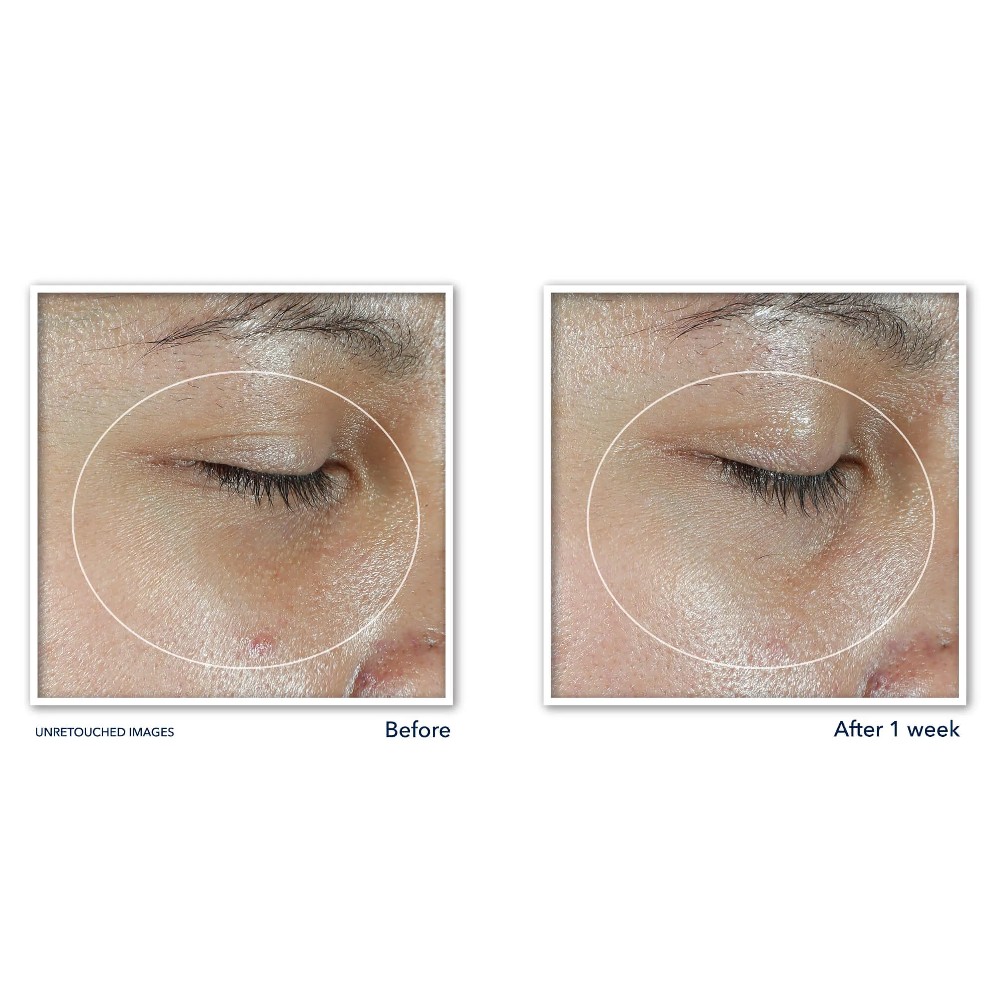 MULTI CORREXION® Revive   Glow Eye Balm